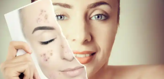 Glutathione price | Shaanxi BLOOM Tech Co., Ltd Glutathione price | Shaanxi BLOOM Tech Co., Ltd